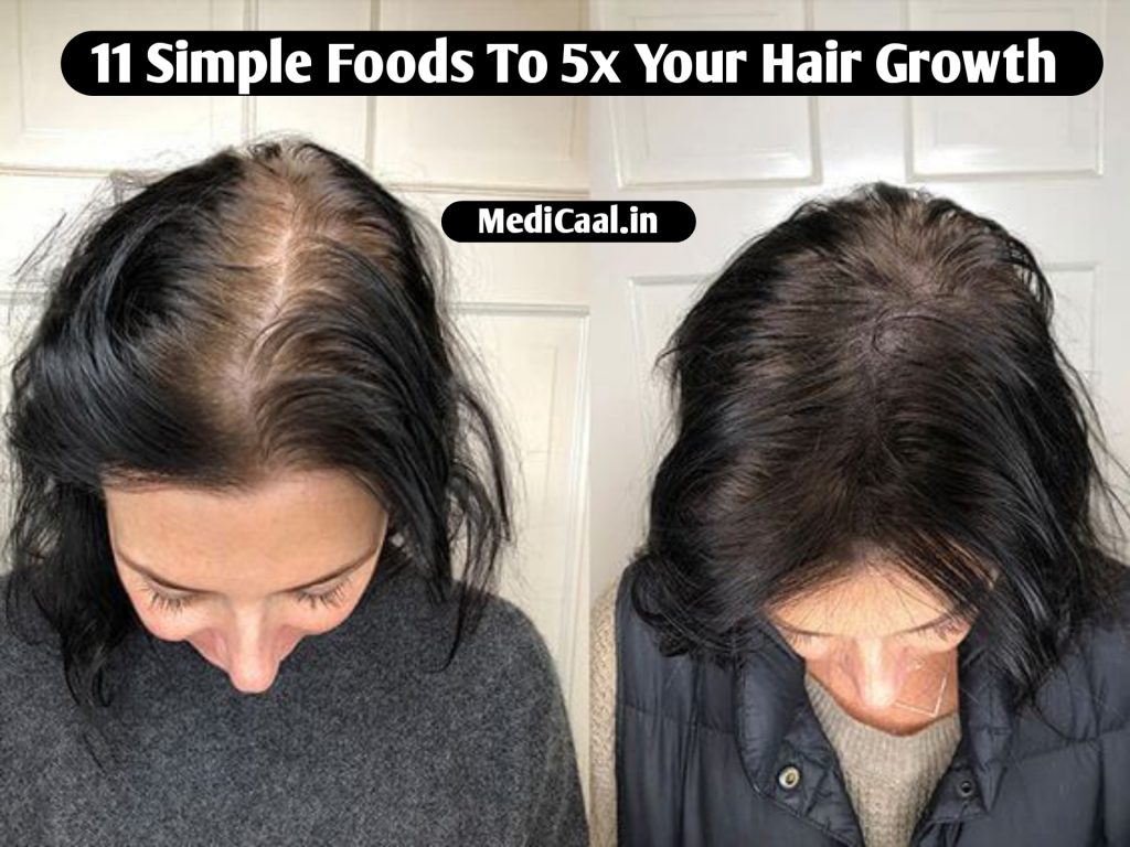 11-simple-foods-to-5x-your-hair-growth-in-15-days-at-almost-zero-cost